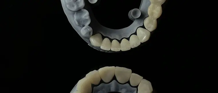Modelos dentários impressos a partir de escaneamento digital